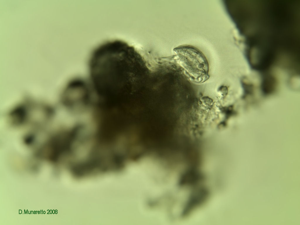 Aspidisca sp.Aspidisca sp.